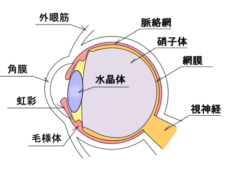 弱視の種類